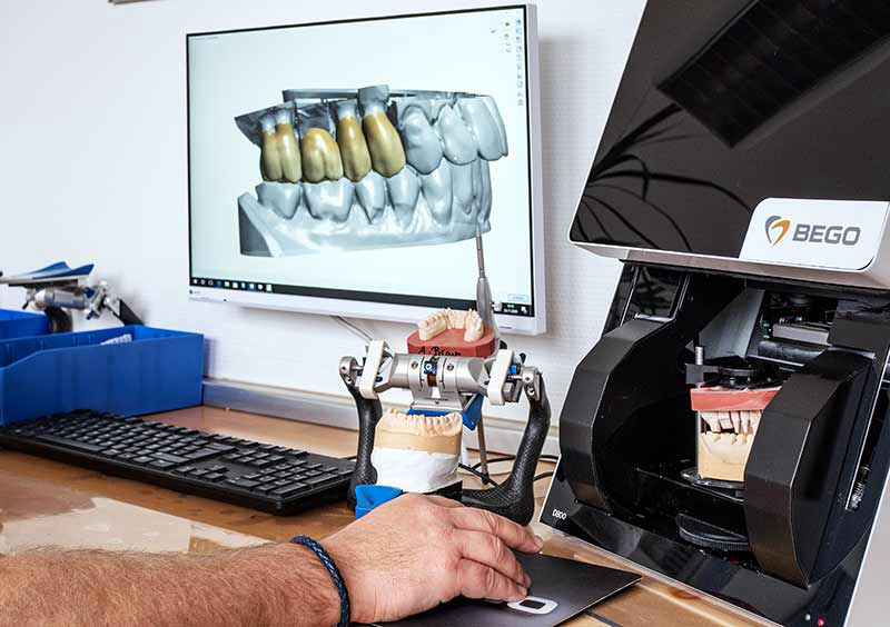 Monitor mit Zahnersatz, Hand im Vordergrund