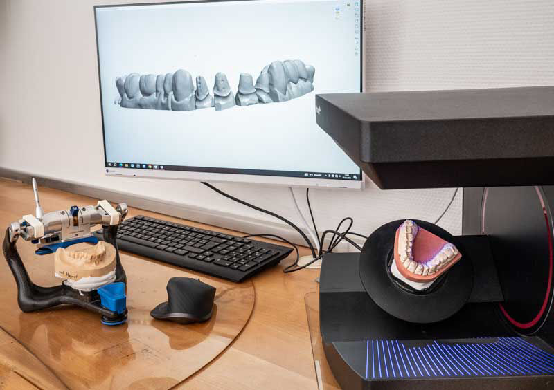 Arbeitsplatz Zahnmodell